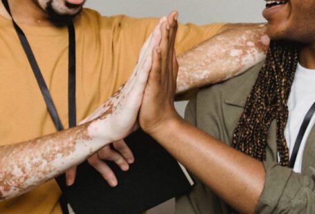 Good Deals - Crop smiling African American male with vitiligo skin giving high five to colleague in studio
